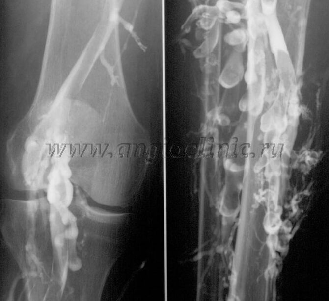 УЗИ сканерлөө